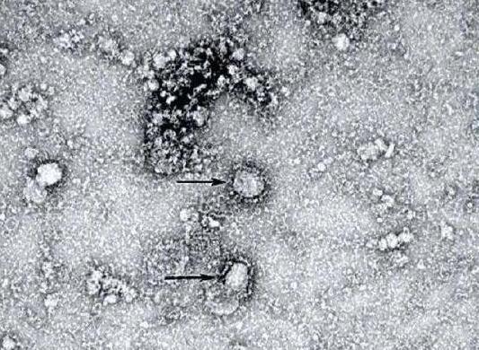 什么是新的冠状病毒：你所需要的所有权威信息