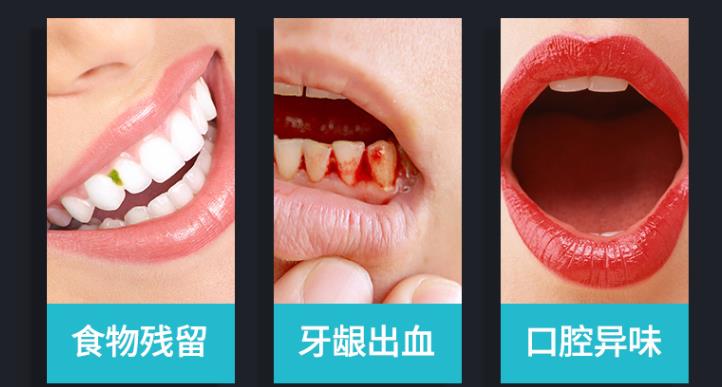 牙齿变黄的原因有哪些（如何预防牙齿变黄）