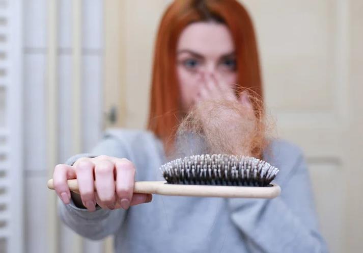 女性容易掉头发不仅是因为缺铁
