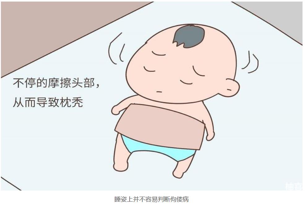 婴儿佝偻病睡姿图片